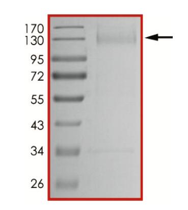 The purity of nCoV-S1 (N501Y, D614G) was determined to be >90% by densitometry